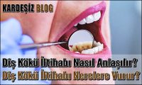 Diş Kökü iltihabı Nasıl Anlaşılır