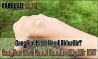 Ganglion Kisti Nasıl Giderilir