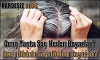 Genç Yaşta Saç Neden Beyazlar
