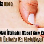 Kıl Kökü iltihabı Nasıl Yok Edilir