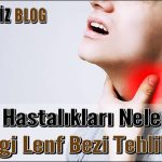 Lenf Hastalıkları Nelerdir