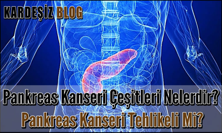 Pankreas Kanseri Çeşitleri Nelerdir