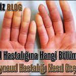 Raynaud Hastalığına Hangi Bölüm Bakar