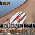Stres Kırığı Olduğunu Nasıl Anlarız