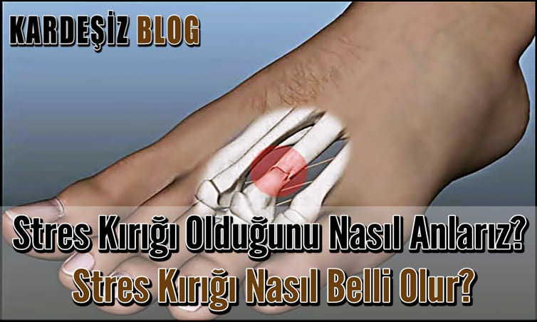 Stres Kırığı Olduğunu Nasıl Anlarız