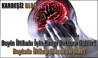 Beyin iltihabı için Hangi Doktora Gidilir