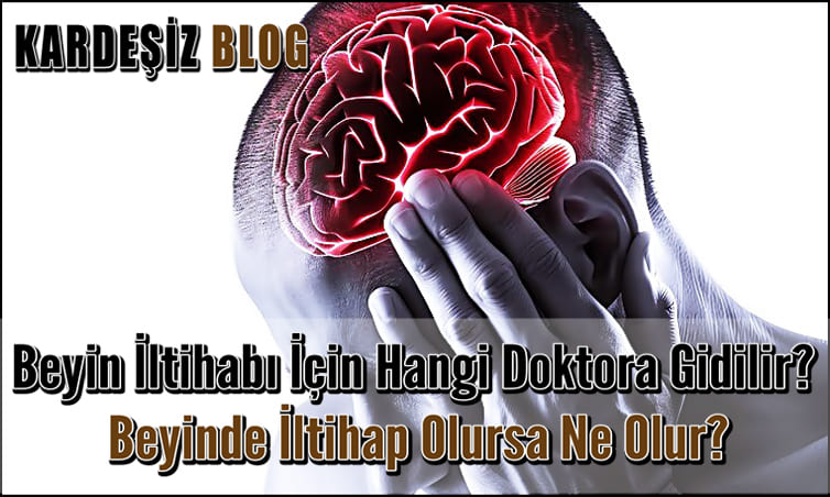 Beyin iltihabı için Hangi Doktora Gidilir