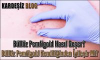 Büllöz Pemfigoid Nasıl Geçer
