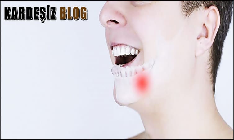 Cam Kemik Hastalığı Doğuştan Mıdır