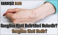 Ganglion Kisti Belirtileri Nelerdir