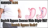 Gastrik Bypass Sonrası Mide Büyür Mü