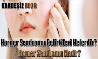 Horner Sendromu Belirtileri Nelerdir