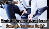Menisküs Yırtılması Nasıl Geçer