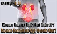 Mesane Kanseri Belirtileri Nelerdir