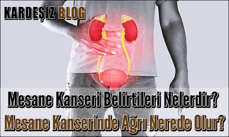 Mesane Kanseri Belirtileri Nelerdir