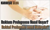 Rektal Prolapsus için Hangi Doktor Bakar