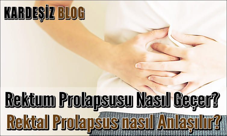 Rektal Prolapsus için Hangi Doktor Bakar