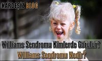 Williams Sendromu Kimlerde Görülür