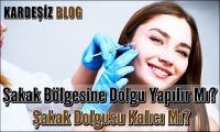 Şakak Bölgesine Dolgu Yapılır Mı