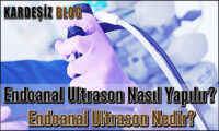 Endoanal Ultrason Nasıl Yapılır