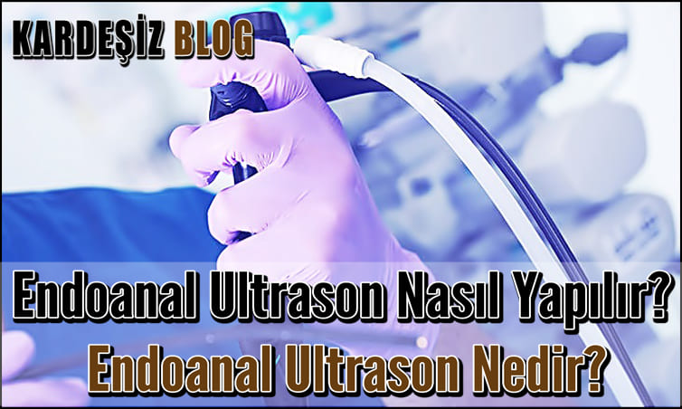 Endoanal Ultrason Nasıl Yapılır