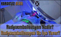 Radyoembolizasyon Nedir