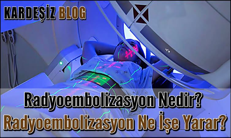 Radyoembolizasyon Nedir