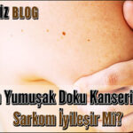 Sarkom Yumuşak Doku Kanseri Nedir