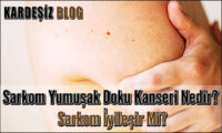 Sarkom Yumuşak Doku Kanseri Nedir
