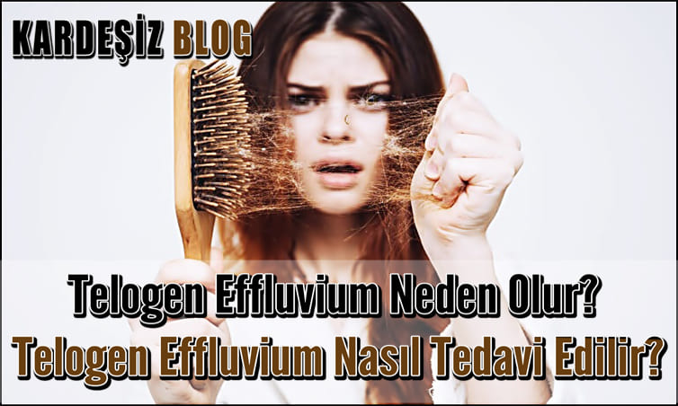 Telogen Effluvium Neden Olur