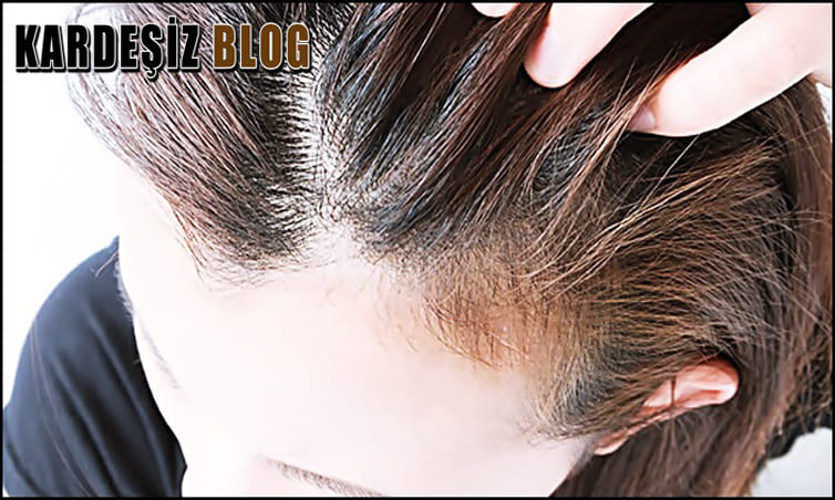 Telogen Effluvium için Hangi Doktora Gidilir