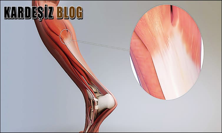 Tendon Hasarı Kaç Günde Geçer