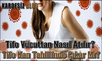 Tifo Vücuttan Nasıl Atılır