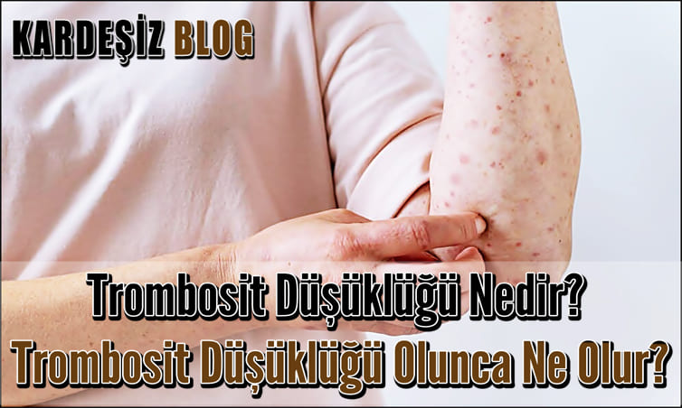 Trombosit Düşüklüğü Nedir