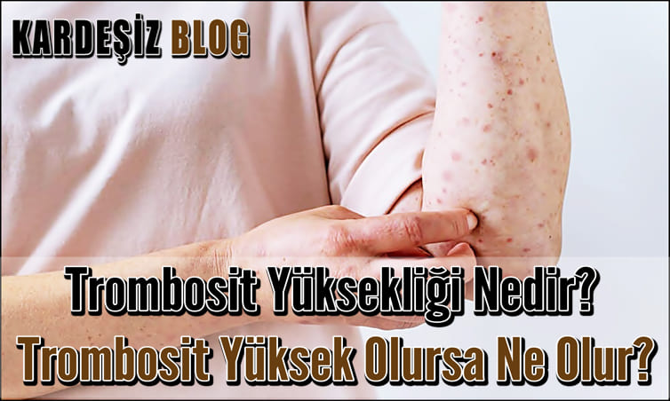 Trombosit Yüksekliği Nedir