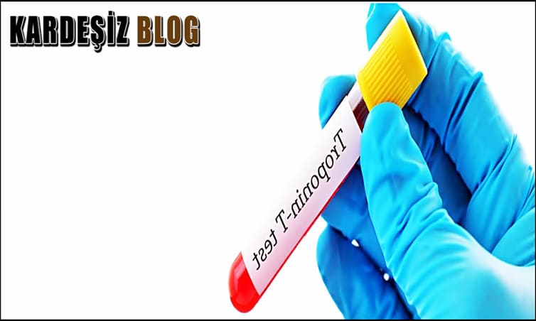 Troponin Kaç Günde Düşer