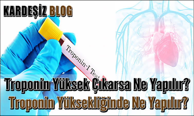 Troponin Yüksek Çıkarsa Ne Yapılır