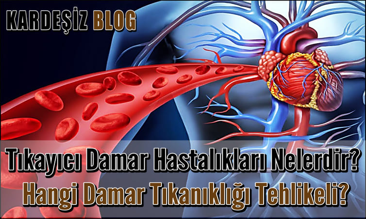 Tıkayıcı Damar Hastalıkları Nelerdir
