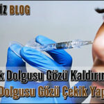 Şakak Dolgusu Gözü Kaldırır Mı