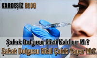 Şakak Dolgusu Gözü Kaldırır Mı