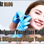 Şakak Dolgusu Yanakları Kaldırır Mı