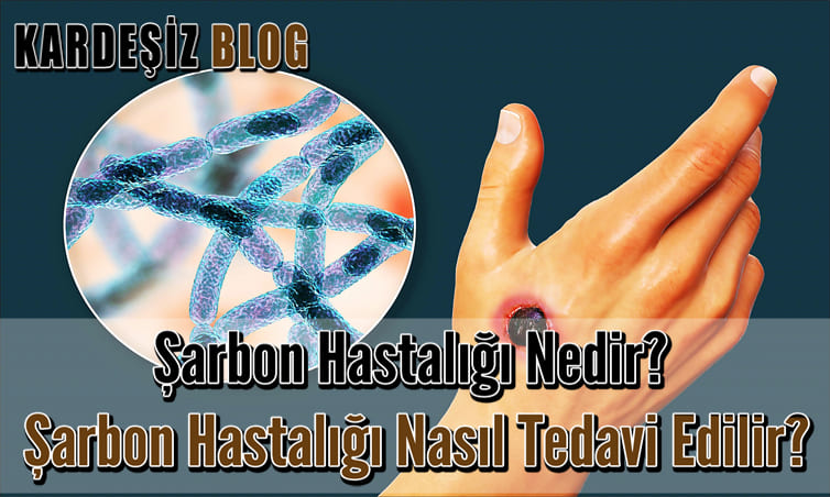 Şarbon Hastalığı Nedir