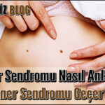 Turner Sendromu Nasıl Anlaşılır
