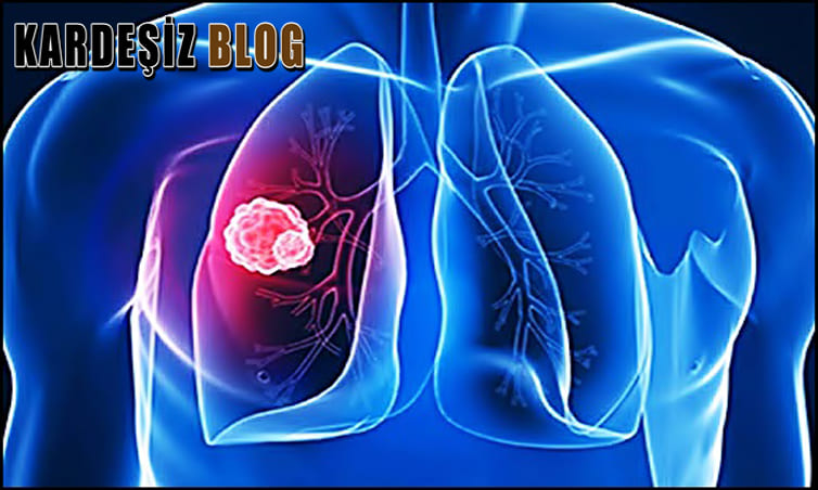 Tüberküloz Hastaları Kaç Yıl Yaşar