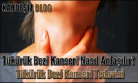 Tükürük Bezi Kanseri Nasıl Anlaşılır