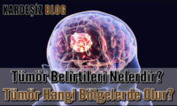 Tümör Belirtileri Nelerdir
