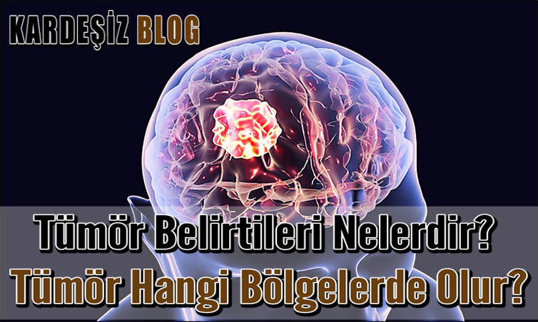 Tümör Belirtileri Nelerdir
