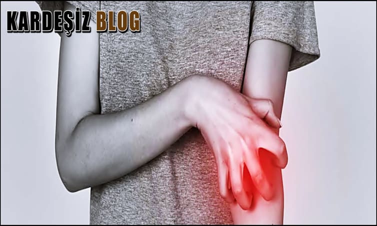 Uyuz Olan Kişinin Yatağı Nasıl Temizlenir