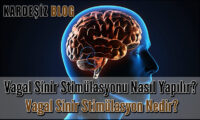 Vagal Sinir Stimülasyonu Nasıl Yapılır