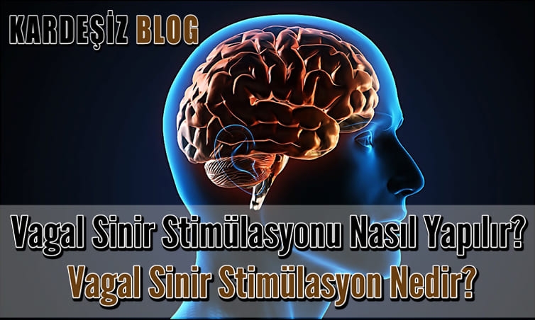 Vagal Sinir Stimülasyonu Nasıl Yapılır